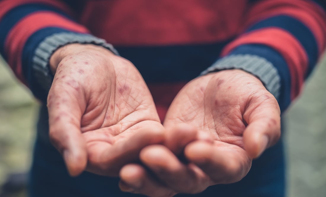 La prevención protege a todos | Imagen ilustrativa