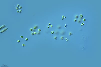 Refuerzan vacunación contra sarampión en Hidalgo con más de 218 mil dosis disponibles