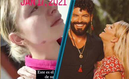 La actriz y cantante de Tulancingo, Sandra Itzel, exhibe su violencia