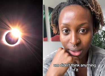 Influencer observa eclipse sin lentes y sufre lesiones en su ojo