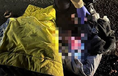 Muere hombre atropellado en la México-Pachuca; conductor se da a la fuga