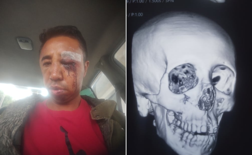 Convocan a marcha en Pachuca tras golpiza contra DJ acusado de robo | Facebook: Yoel Chavez Yoel Chavez