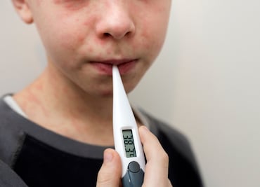 Hidalgo refuerza campaña contra el sarampión; Salud invita a hospitales privados a sumarse a la vacunación infantil