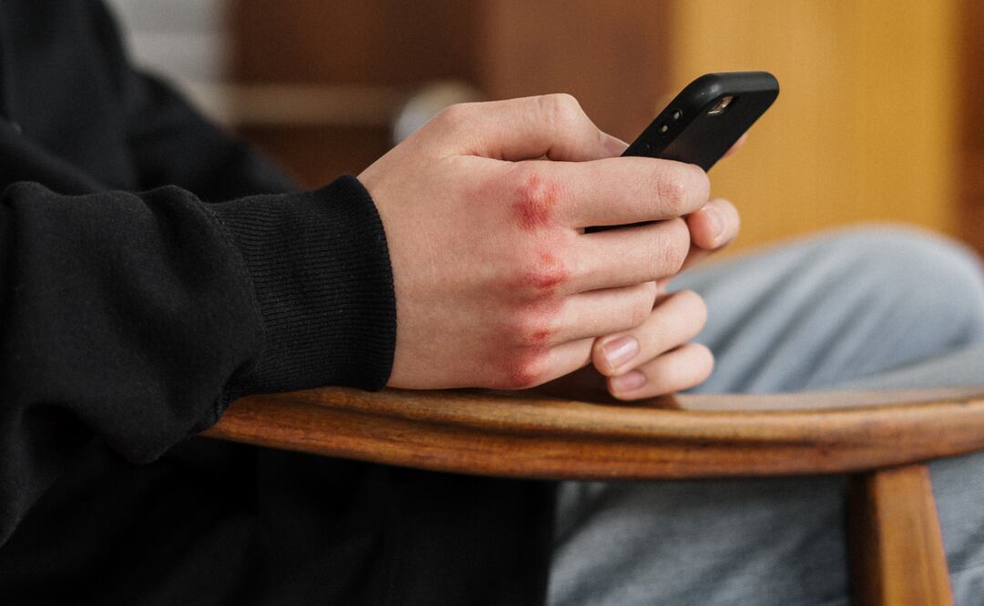 En educación media superior y superior se denunciaron 60 casos de acoso y violencia escolar, de los cuales atendieron 41 | Foto: Pexels