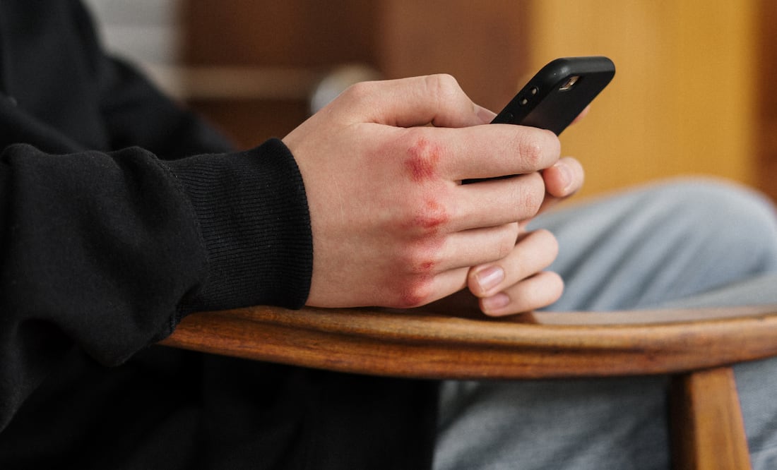 En educación media superior y superior se denunciaron 60 casos de acoso y violencia escolar, de los cuales atendieron 41 | Foto: Pexels