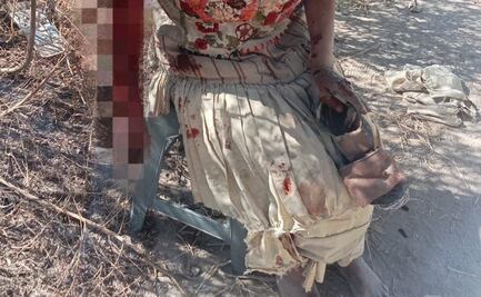 Mujer de la tercera edad es atacada por jauría en Tizayuca