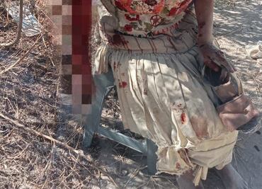 Mujer de la tercera edad es atacada por jauría en Tizayuca