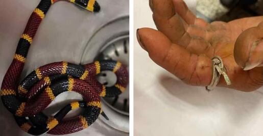 Salud emite alerta ante incremento de mordeduras y picaduras de animales ponzoñosos