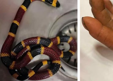 Salud emite alerta ante incremento de mordeduras y picaduras de animales ponzoñosos