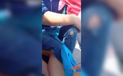 Preocupa aumento de perros callejeros en Tizayuca; reportan ataque a una mujer