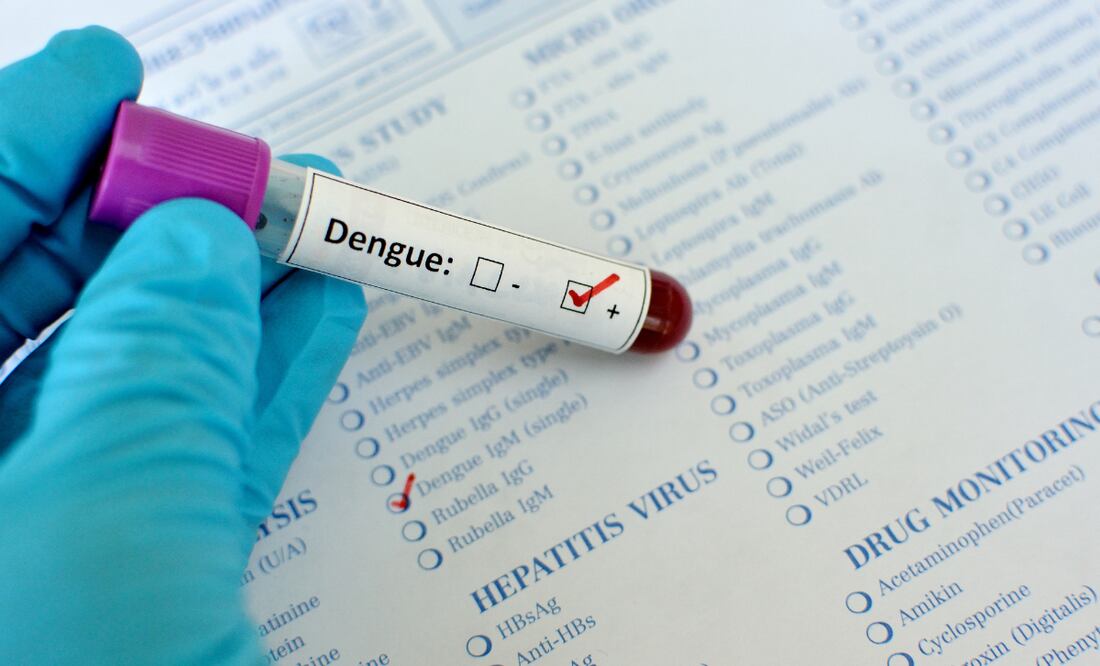Hidalgo entre las entidades con más casos de dengue en el país | Imagen ilustrativa